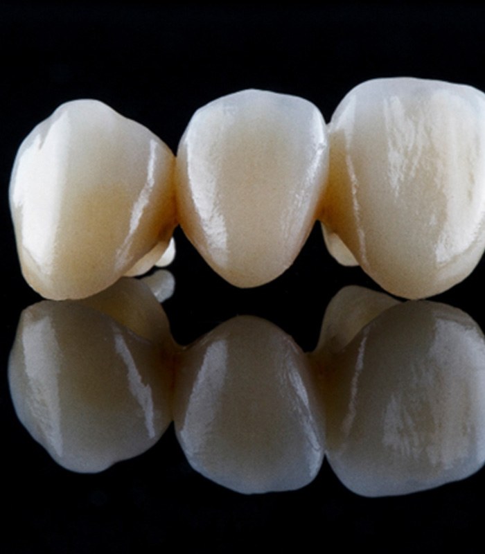 a dental bridge against a black background