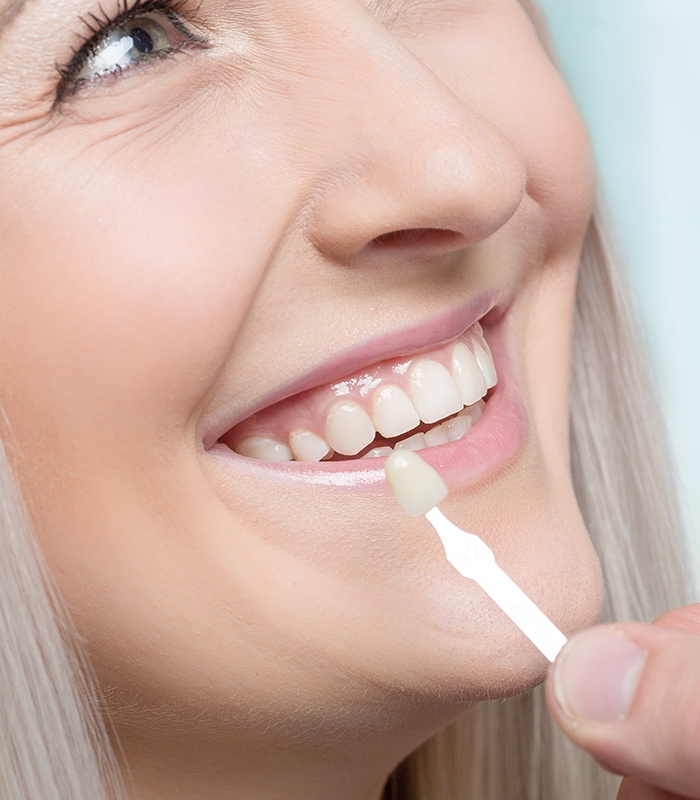 Woman's smile compared with porcelain veneer color chart during cosmetic dentistry treatment