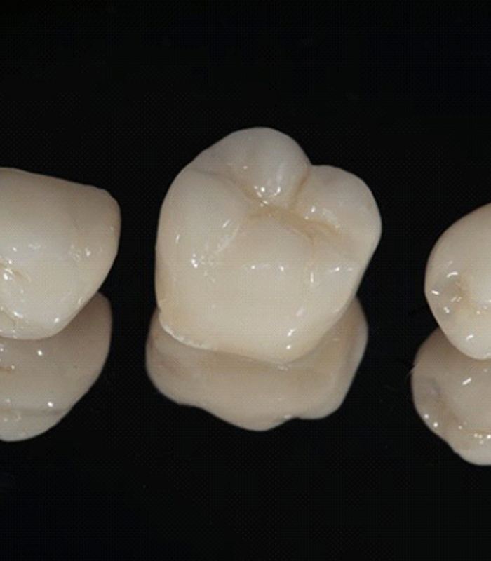 three dental crowns in front of a black background