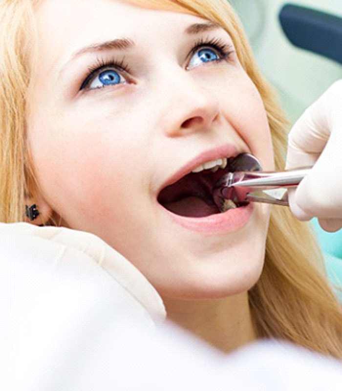 young woman having her tooth extracted by a dentist in Jonesboro