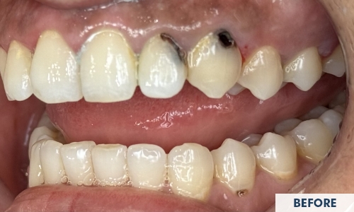 Before treatment