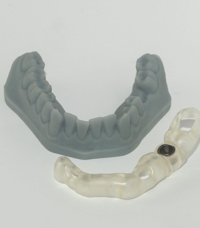 dental implant surgical guide next to mold of mouth 