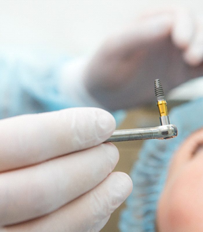 Dentist carefully preparing to place implant during surgery