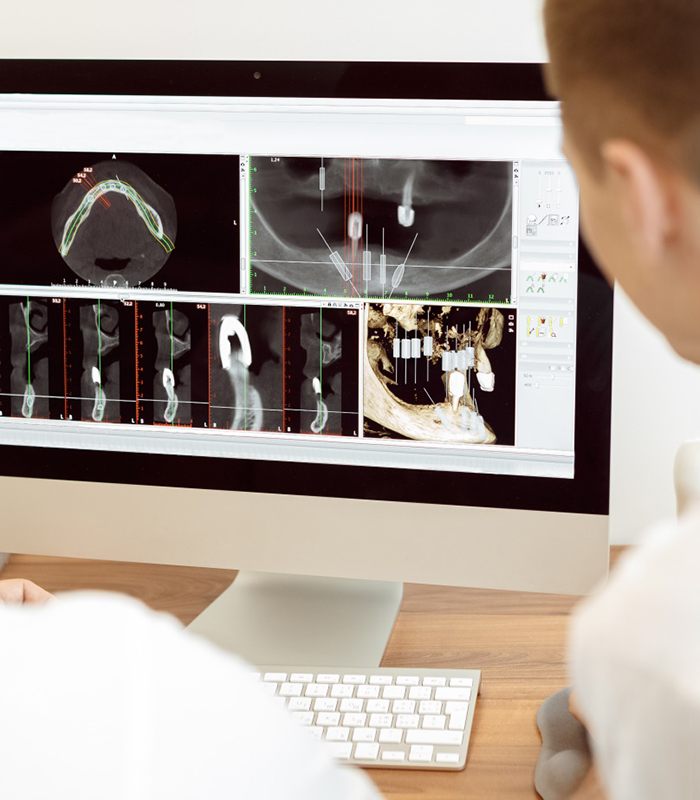 Dentists collaborating in front of computer monitor