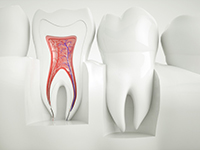 An illustration of factors involved in the cost of a root canal in Jonesboro