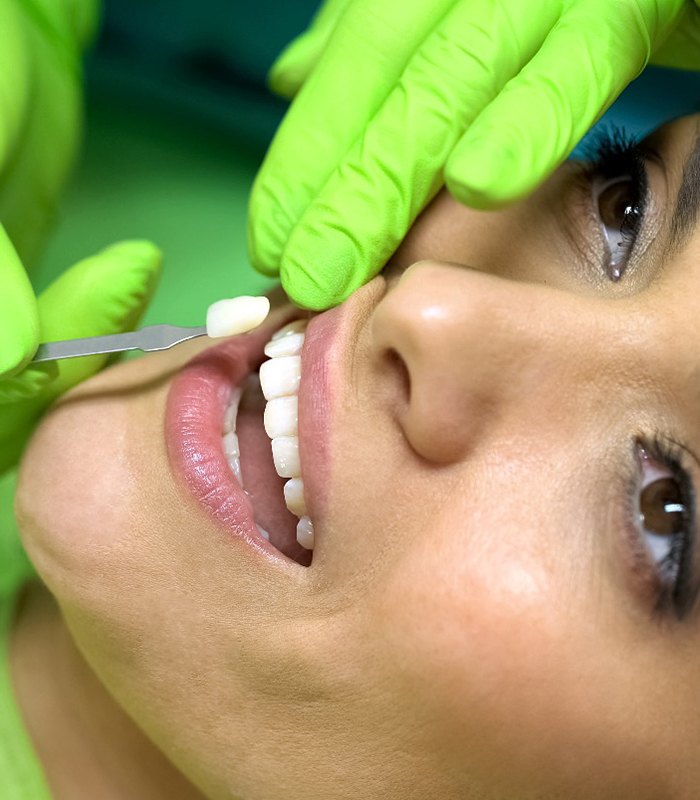 Woman having veneers placed in Jonesboro