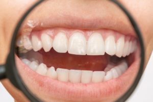 closeup of tooth enamel